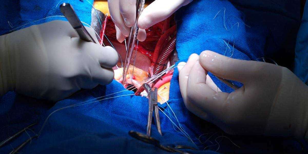 Heart Surgery Doctor in India - Dr. Sujay Shad